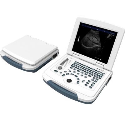Full-Digital Laptop Ultrasound Scanner ME-580