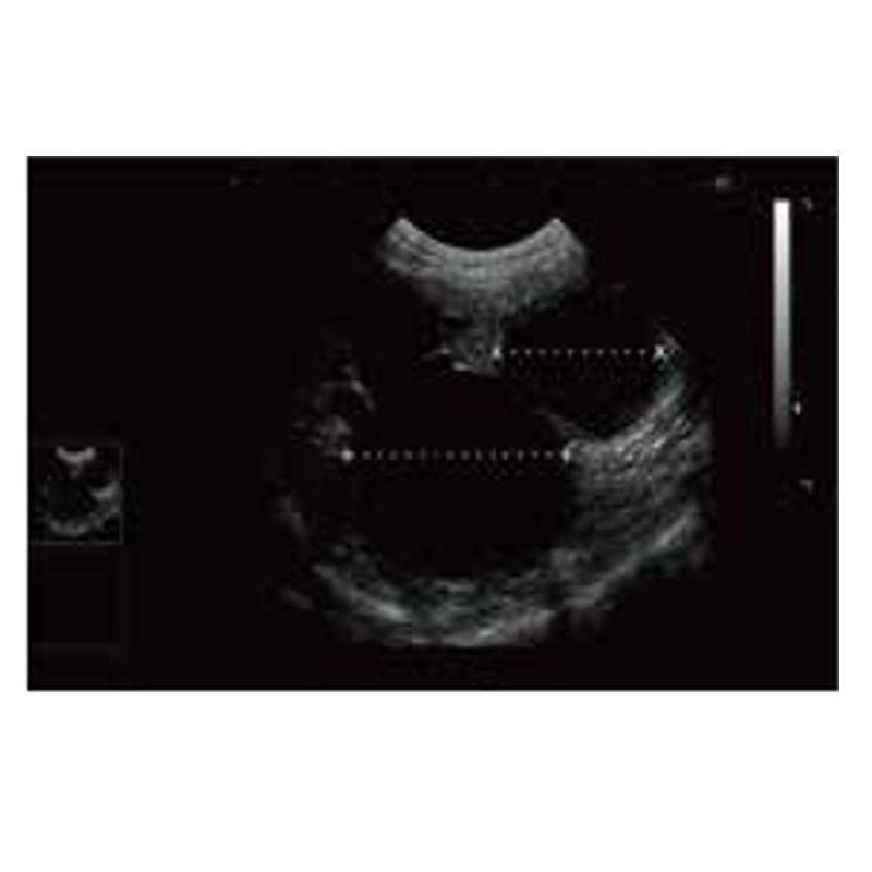 Pet Hospital Animal Medical Instruments Veterinary black and white ultrasound diagnostic system VDL121A