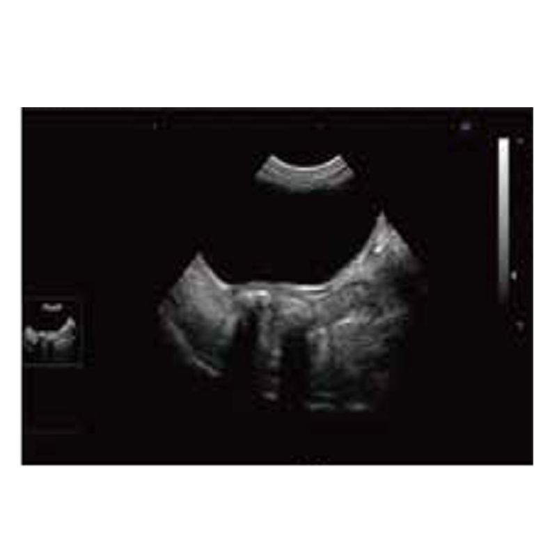Animal Veterinary Medical Equipments black and white ultrasound diagnostic system VDL151A 