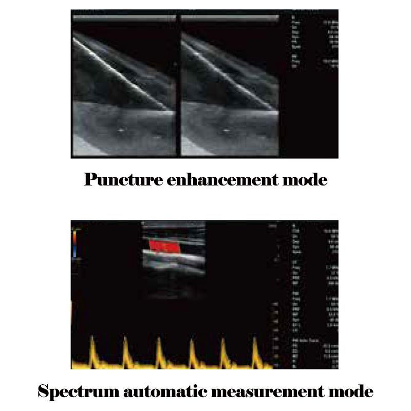 For Veterinary Used Medical Device Cardiac Ultrasound System VMT241A 