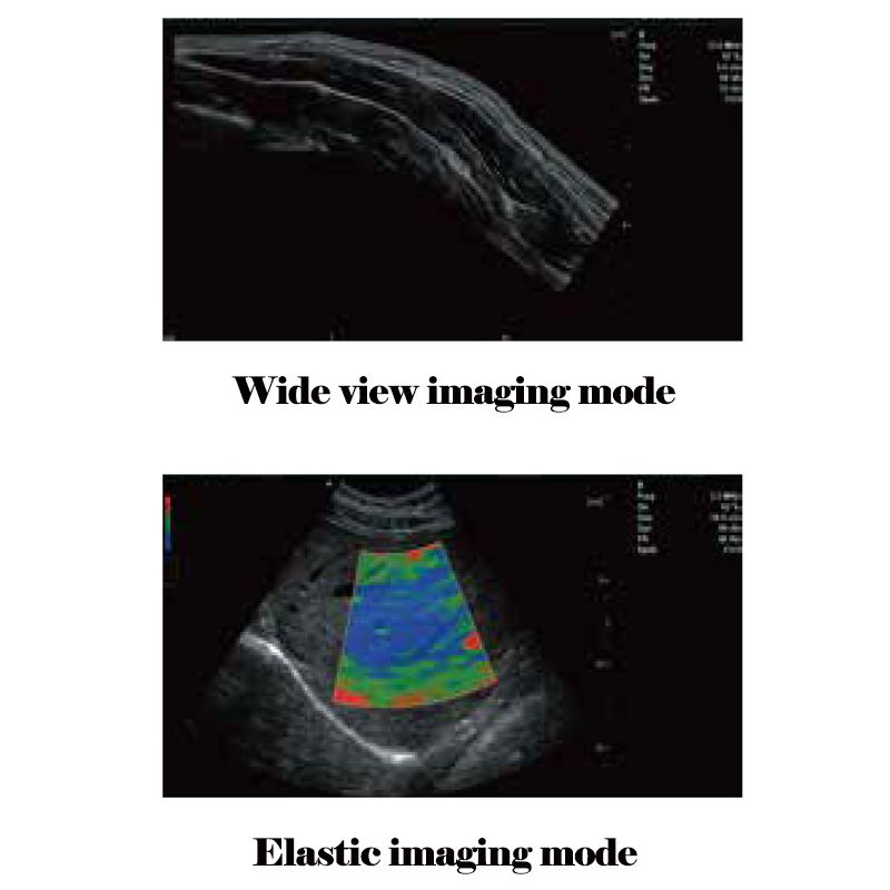 For Veterinary Used Medical Device Cardiac Ultrasound System VMT241A 